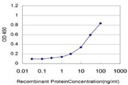 Monoclonal Anti-UBE2Q2 antibody produced in mouse clone 2H3, purified immunoglobulin, buffered aqueous solution