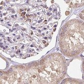 Anti-RPS5 antibody produced in rabbit Prestige Antibodies® Powered by Atlas Antibodies, affinity isolated antibody, buffered aqueous glycerol solution