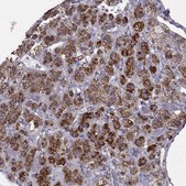 Anti-TPP1 antibody produced in rabbit Prestige Antibodies® Powered by Atlas Antibodies, affinity isolated antibody, buffered aqueous glycerol solution