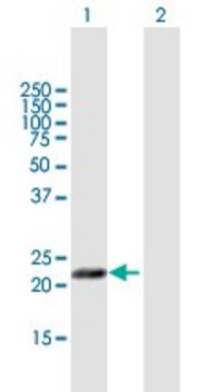 Anti-MFAP5 antibody produced in mouse purified immunoglobulin, buffered aqueous solution