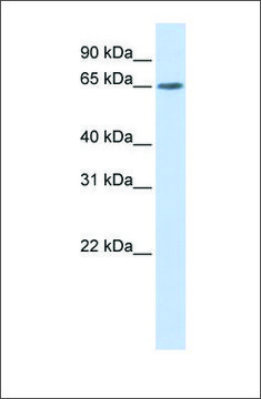 Anti-YTHDF3 antibody produced in rabbit affinity isolated antibody