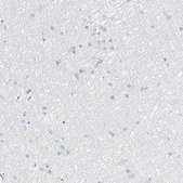 Anti-PRSS23 antibody produced in rabbit Prestige Antibodies® Powered by Atlas Antibodies, affinity isolated antibody, buffered aqueous glycerol solution