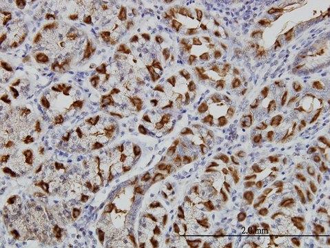 Monoclonal Anti-WWP1 antibody produced in mouse clone 1A7, purified immunoglobulin, buffered aqueous solution