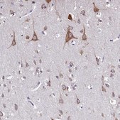 Anti-WDR35 antibody produced in rabbit affinity isolated antibody, buffered aqueous glycerol solution