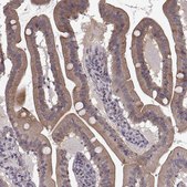 Anti-SLC22A18 antibody produced in rabbit Prestige Antibodies® Powered by Atlas Antibodies, affinity isolated antibody