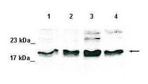 Anti-SOD1 IgG fraction of antiserum