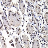 Anti- macroH2A.1 antibody produced in rabbit