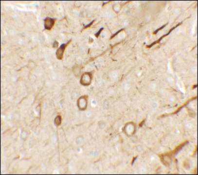 Anti-PRRT2 antibody produced in rabbit affinity isolated antibody, buffered aqueous solution