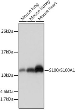 Anti-S100/S100A1 Antibody, clone 5L10L1, Rabbit Monoclonal