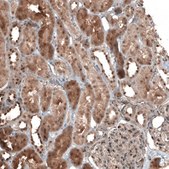Anti-NUDT16L1 antibody produced in rabbit Prestige Antibodies® Powered by Atlas Antibodies, affinity isolated antibody, buffered aqueous glycerol solution