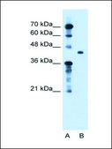 Anti-TGFBI antibody produced in rabbit IgG fraction of antiserum