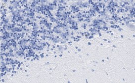 Anti-MDM2 Antibody, clone Z6H3 ZooMAb® Rabbit Monoclonal recombinant, expressed in HEK 293 cells