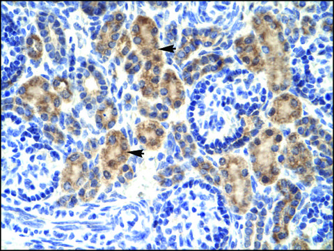 Anti-MyCBP antibody produced in rabbit affinity isolated antibody