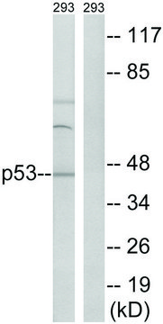 Anti-p53 antibody produced in rabbit affinity isolated antibody