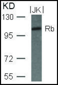 Anti-RB1 (Ab-780) antibody produced in rabbit affinity isolated antibody