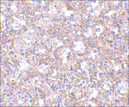 Anti-TEM4 antibody produced in rabbit affinity isolated antibody, buffered aqueous solution