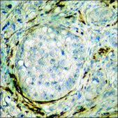 Anti-phospho-Caldesmon (pSer789) antibody produced in rabbit affinity isolated antibody