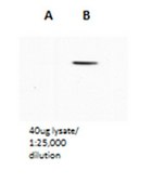 Anti-IFIT3 Antibody serum, from rabbit