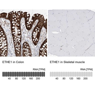 Anti-ETHE1 antibody produced in rabbit Prestige Antibodies&#174; Powered by Atlas Antibodies, affinity isolated antibody, buffered aqueous glycerol solution, ab3