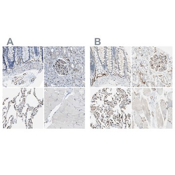 Anti-CD93 antibody produced in rabbit Prestige Antibodies&#174; Powered by Atlas Antibodies, affinity isolated antibody, buffered aqueous glycerol solution