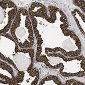 Anti-MBOAT2 antibody produced in rabbit Prestige Antibodies® Powered by Atlas Antibodies, affinity isolated antibody, buffered aqueous glycerol solution