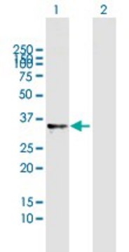 Anti-RNASET2 antibody produced in mouse purified immunoglobulin, buffered aqueous solution