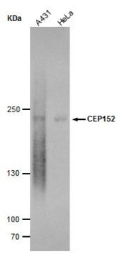 Monoclonal Anti-CEP152 antibody produced in mouse clone GT1315, affinity isolated antibody