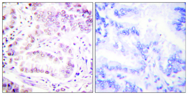 Anti-Histone H3 (Acetyl-Lys27) antibody produced in rabbit affinity isolated antibody