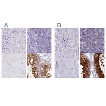 Anti-LZTFL1 antibody produced in rabbit Prestige Antibodies&#174; Powered by Atlas Antibodies, affinity isolated antibody, buffered aqueous glycerol solution