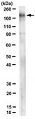 Anti-Tenascin-R Antibody, clone 23-14