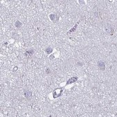 Anti-PLCB3 antibody produced in rabbit Prestige Antibodies® Powered by Atlas Antibodies, affinity isolated antibody, buffered aqueous glycerol solution