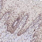 Anti-CD3EAP antibody produced in rabbit Prestige Antibodies® Powered by Atlas Antibodies, affinity isolated antibody, buffered aqueous glycerol solution