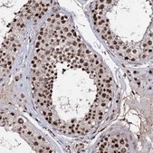 Anti-PRPF40A antibody produced in rabbit Prestige Antibodies® Powered by Atlas Antibodies, affinity isolated antibody, buffered aqueous glycerol solution