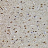 Anti-Phospho-Tau-T217 antibody produced in rabbit