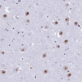 Anti-U2AF1 antibody produced in rabbit Prestige Antibodies® Powered by Atlas Antibodies, affinity isolated antibody, buffered aqueous glycerol solution