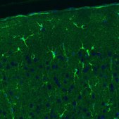 Monoclonal Anti-GLUL antibody produced in mouse Prestige Antibodies® Powered by Atlas Antibodies, clone CL3013, purified immunoglobulin, buffered aqueous glycerol solution