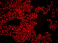 LOX-IMVI Human Melanoma Cell Line LOX-IMVI human melanoma cell line is an excellent model for probing mechanisms of metastasis and for evaluation of chemotherapies.