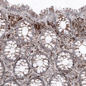 Monoclonal Anti-LAMP1 antibody produced in mouse Prestige Antibodies® Powered by Atlas Antibodies, clone CL4489, purified immunoglobulin