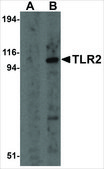 Anti-TLR2 antibody produced in rabbit affinity isolated antibody, buffered aqueous solution
