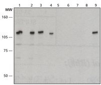 Anti-XPC (C-terminal) antibody produced in rabbit ~1 mg/mL, affinity isolated antibody, buffered aqueous solution