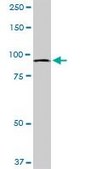 Monoclonal Anti-MTSS1 antibody produced in mouse clone 2G9, purified immunoglobulin, buffered aqueous solution