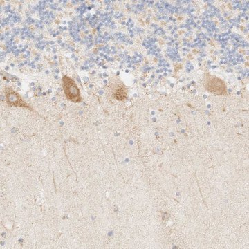 Anti-MYO10 antibody produced in rabbit Prestige Antibodies&#174; Powered by Atlas Antibodies, affinity isolated antibody, buffered aqueous glycerol solution