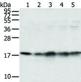 Anti-TAF11 affinity isolated antibody