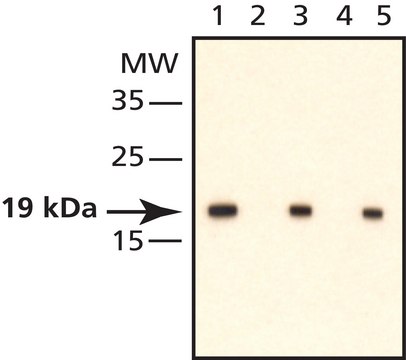 Monoclonal Ant-phospho-Cofilin (pSer3) 兔抗 IgG fraction of antiserum, buffered aqueous solution