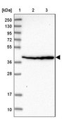 Anti-SCARA3 antibody produced in rabbit Prestige Antibodies® Powered by Atlas Antibodies, affinity isolated antibody, buffered aqueous glycerol solution