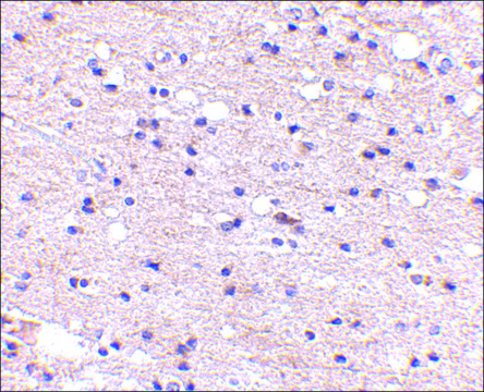 Anti-Ambra1 (ab1) antibody produced in rabbit affinity isolated antibody, buffered aqueous solution