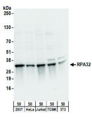 Rabbit anti-RPA32 Antibody, Affinity Purified Powered by Bethyl Laboratories, Inc.