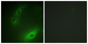 Anti-FOXO1A antibody produced in rabbit affinity isolated antibody