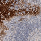 Anti-SDR16C5 antibody produced in rabbit Prestige Antibodies® Powered by Atlas Antibodies, affinity isolated antibody, buffered aqueous glycerol solution