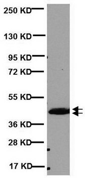 Anti-CNPase Antibody, clone 11-5B clone 11-5B, Chemicon&#174;, from mouse